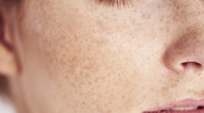 Mikrobiom skóry - co tak naprawdę ma wpływ na wygląd naszej cery?